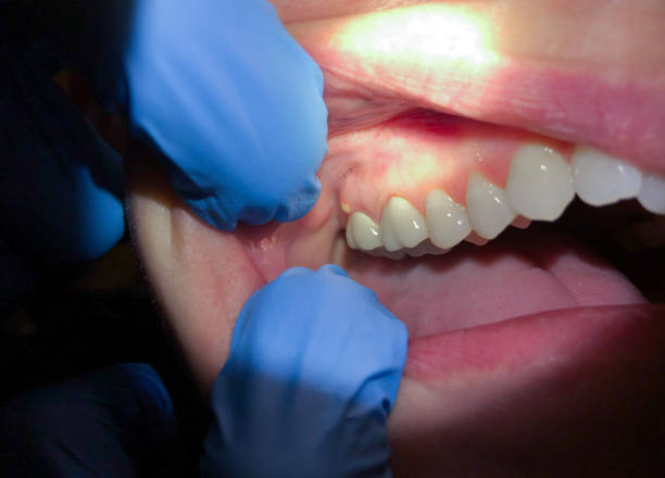 Best Emergency Dental Surgery in Eufaula, OK