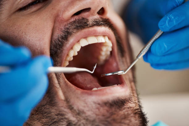 Best Walk-In Emergency Dentist in Eufaula, OK